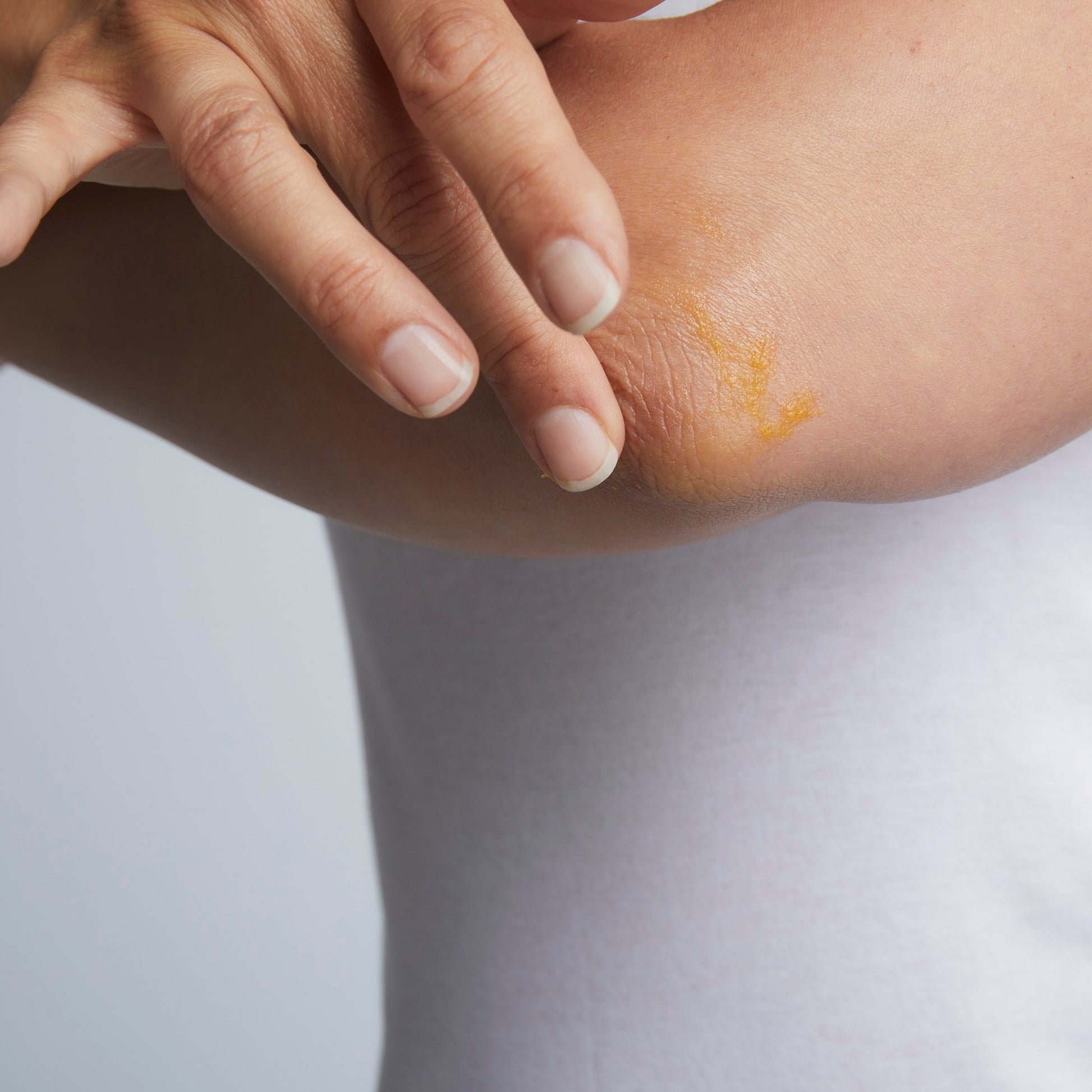 MV Skintherapy multiBALM application on elbow - Margot Body